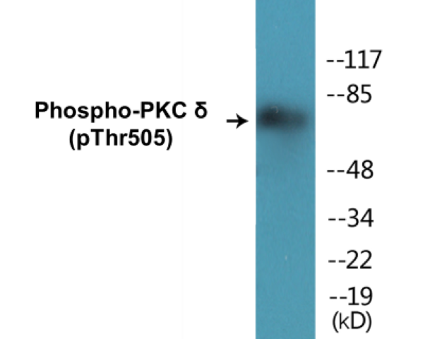 PKC delta (phospho Thr505) Cell Based ELISA Kit