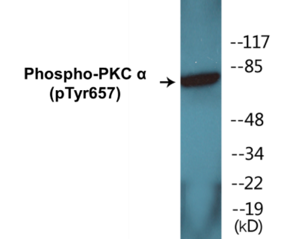 PKC alpha (phospho Tyr657) Cell Based ELISA Kit