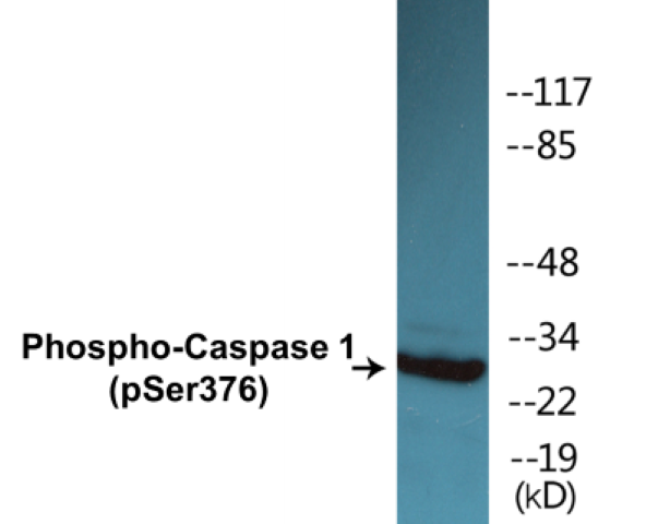 Caspase 1 (phospho Ser376) Cell Based ELISA Kit