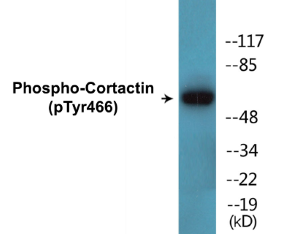 Cortactin (phospho Tyr466) Cell Based ELISA Kit
