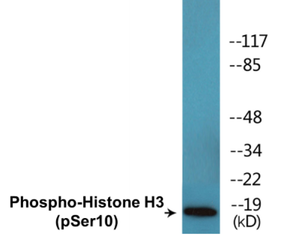 Histone H3 (phospho Ser10) Cell Based ELISA Kit