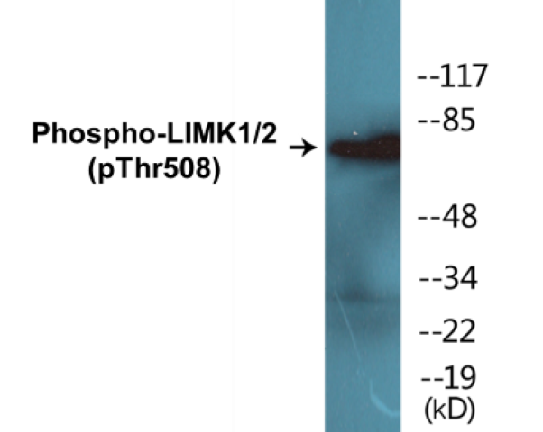 LIMK1 + 2 (phospho Thr508) Cell Based ELISA Kit