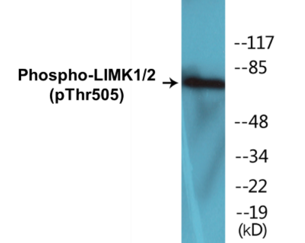 LIMK1 + 2 (phospho Thr505) Cell Based ELISA Kit