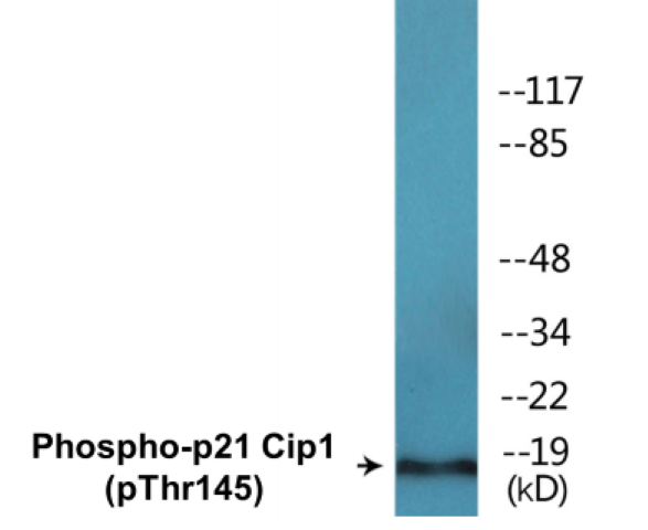 p21 Cip 1 (phospho Thr145) Cell Based ELISA Kit