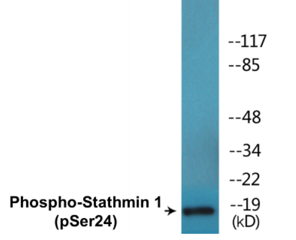 Stathmin 1 (phospho Ser24) Cell Based ELISA Kit
