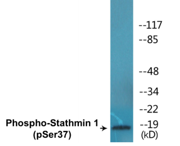 Stathmin 1 (phospho Ser37) Cell Based ELISA Kit