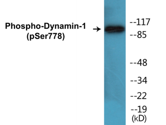 Dynamin-1 (phospho Ser778) Cell Based ELISA Kit