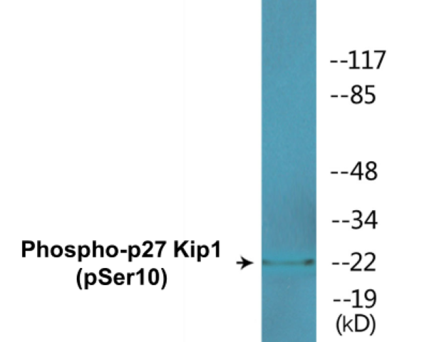 p27 Kip 1 (phospho Ser10) Cell Based ELISA Kit