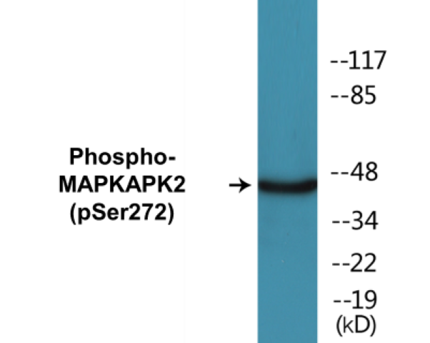 MAPKAPK2 (phospho Ser272) Cell Based ELISA Kit