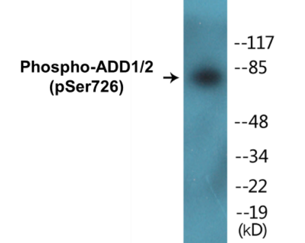 ADD1 + 2 (phospho Ser726) Cell Based ELISA Kit