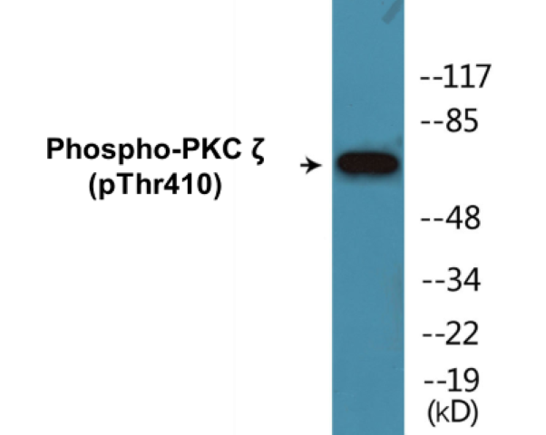 PKC zeta (phospho Thr410) Cell Based ELISA Kit