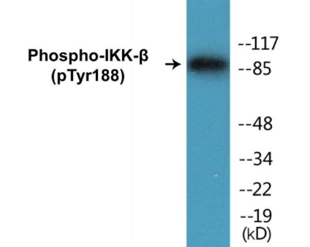 IKK beta (phospho Tyr188) Cell Based ELISA Kit
