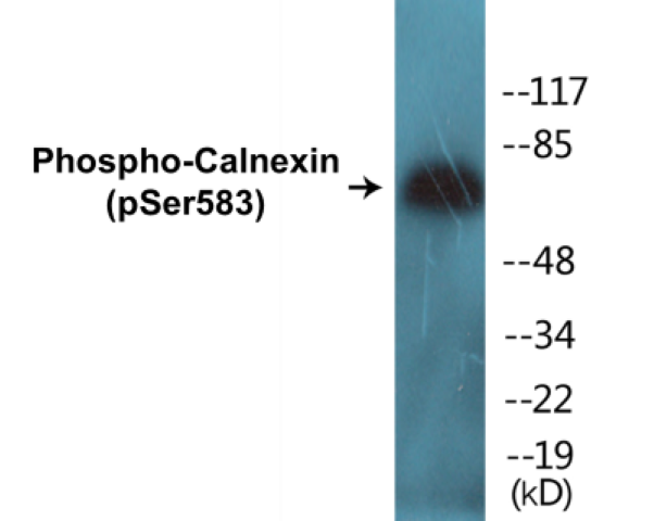 Calnexin (phospho Ser583) Cell Based ELISA Kit