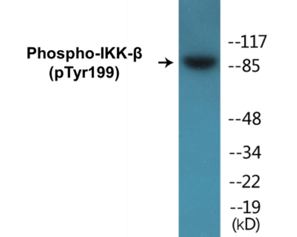 IKK beta (phospho Tyr199) Cell Based ELISA Kit