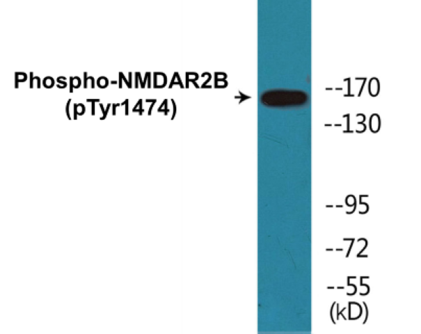 NMDAR2B (phospho Tyr1474) Cell Based ELISA Kit