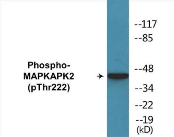 MAPKAPK2 (phospho Thr222) Cell Based ELISA Kit