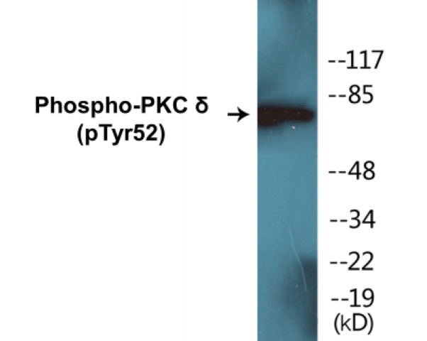 PKC delta (phospho Tyr52) Cell Based ELISA Kit