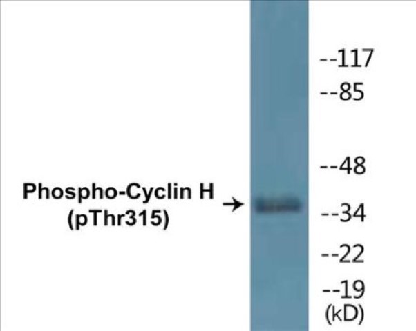 Cyclin H (phospho Thr315) Cell Based ELISA Kit