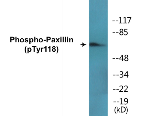Paxillin (phospho Tyr118) Cell Based ELISA Kit