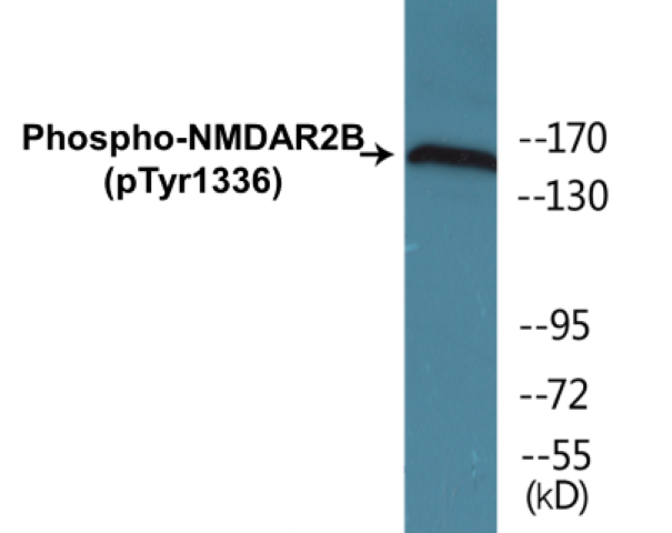 NMDAR2B (phospho Tyr1336) Cell Based ELISA Kit