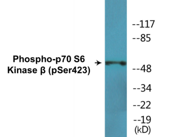 p70S6 Kinase beta (phospho Ser423) Cell Based ELISA Kit