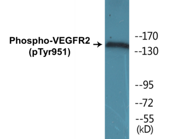 VEGFR2 (phospho Tyr951) Cell Based ELISA Kit
