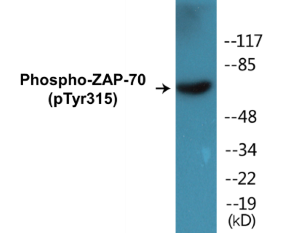 ZAP-70 (phospho Tyr315) Cell Based ELISA Kit