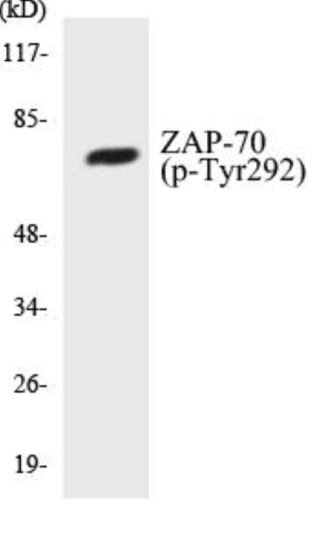 ZAP-70 (phospho Tyr292) Cell Based ELISA Kit