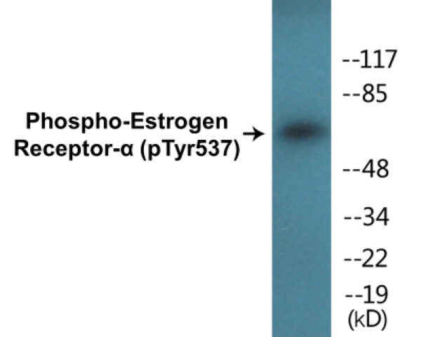 Estrogen Receptor alpha (phospho Tyr537) Cell Based ELISA Kit