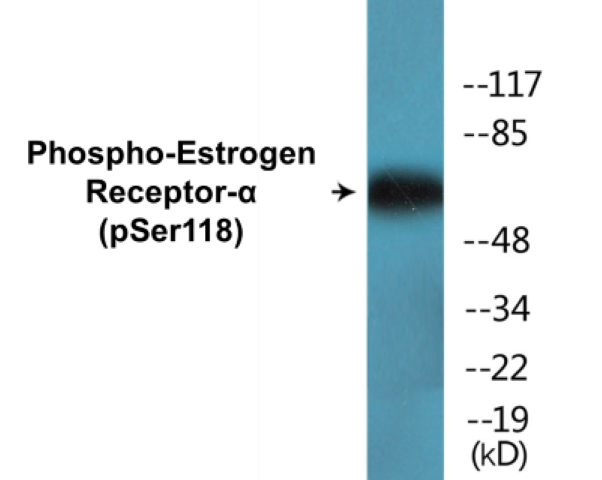 Estrogen Receptor alpha (phospho Ser118) Cell Based ELISA Kit
