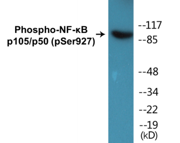 NF-kB p105 / p50 (phospho Ser927) Cell Based ELISA Kit