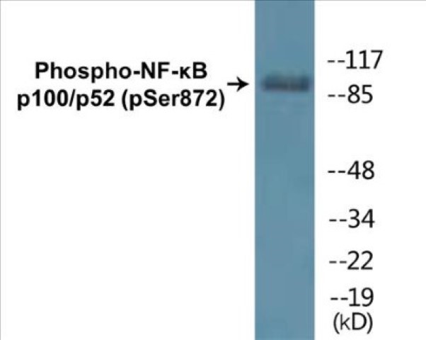 NF-kB p100 / p52 (phospho Ser872) Cell Based ELISA Kit