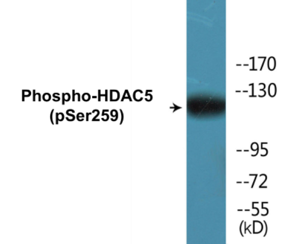 HDAC5 (phospho Ser259) Cell Based ELISA Kit
