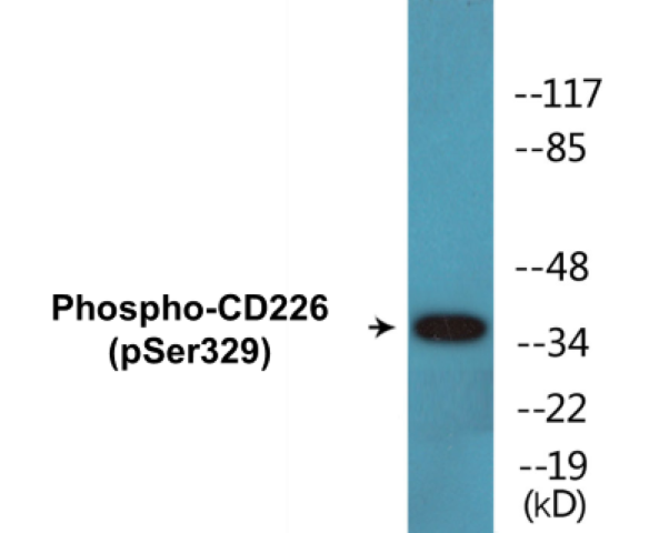 CD226 (phospho Ser329) Cell Based ELISA Kit