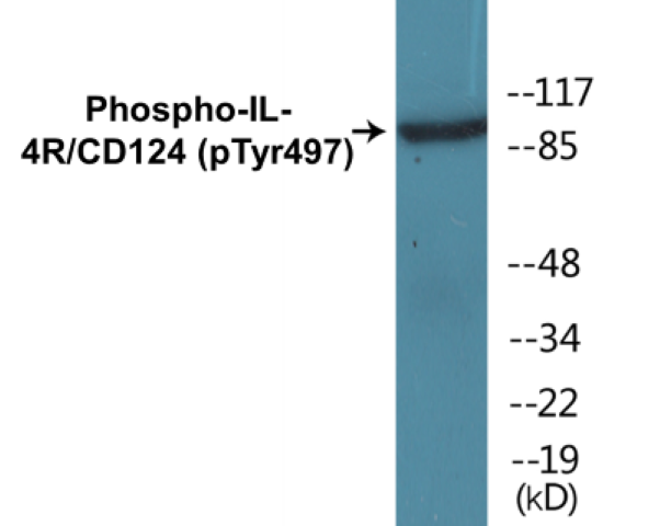 IL-4R (phospho Tyr497) Cell Based ELISA Kit