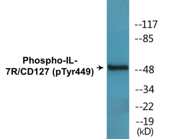 IL-7R (phospho Tyr449) Cell Based ELISA Kit