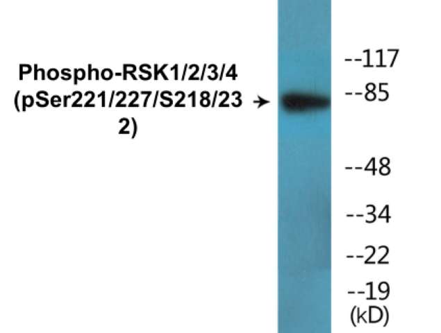 RSK1 + 2 + 3 + 4 (phospho Ser221 + Ser227 + Ser218 + Ser232) Cell Based ELISA Kit