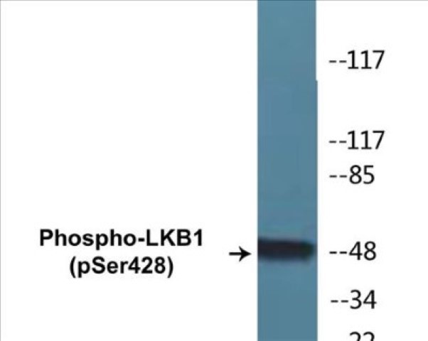 LKB1 (phospho Ser428) Cell Based ELISA Kit