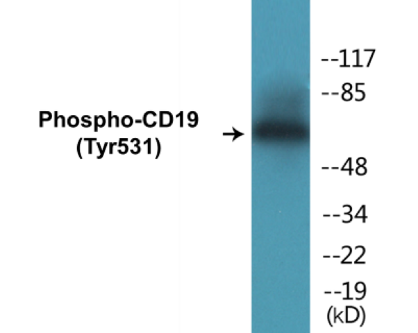 CD19 (phospho Tyr531) Cell Based ELISA Kit