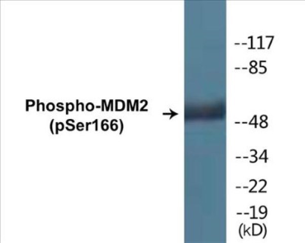 MDM2 (phospho Ser166) Cell Based ELISA Kit