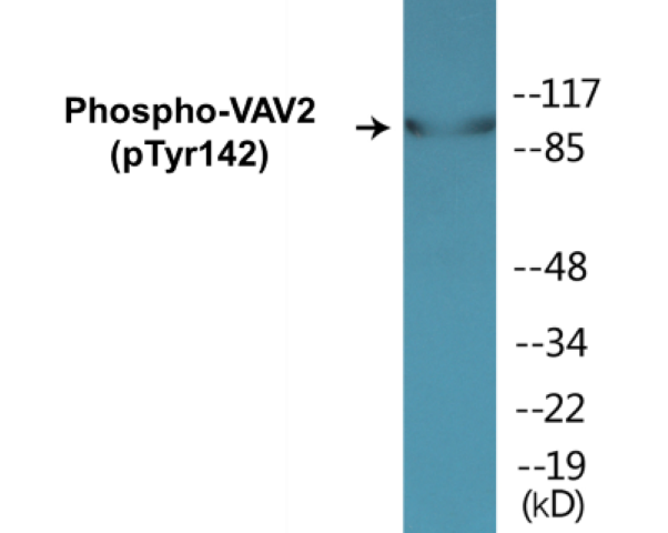 VAV2 (phospho Tyr142) Cell Based ELISA Kit