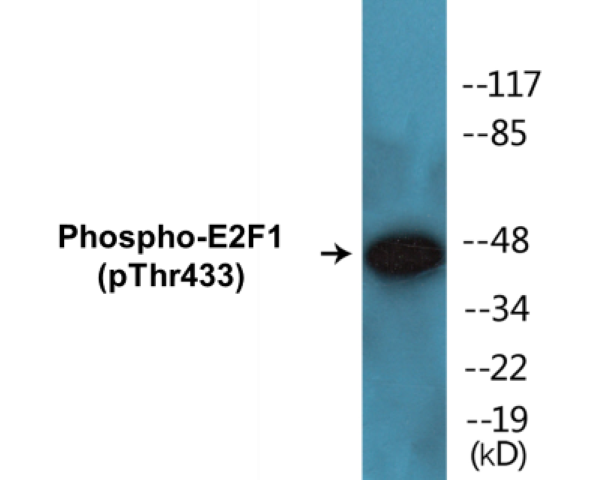 E2F1 (phospho Thr433) Cell Based ELISA Kit
