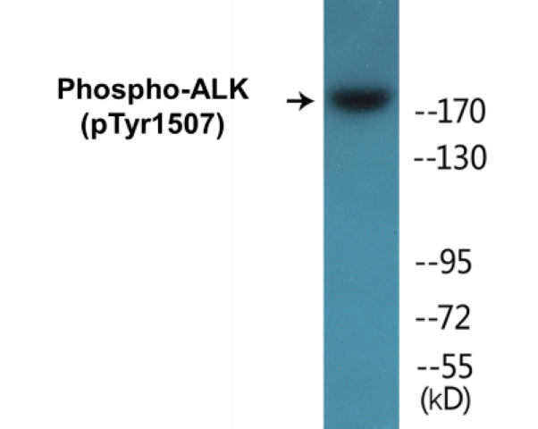 ALK (phospho Tyr1507) Cell Based ELISA Kit