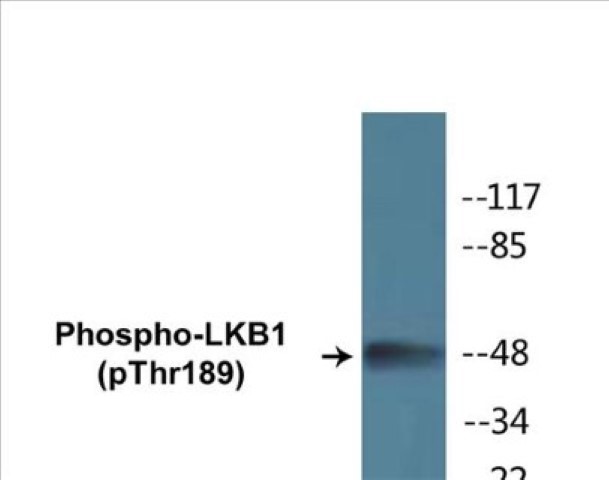 LKB1 (phospho Thr189) Cell Based ELISA Kit