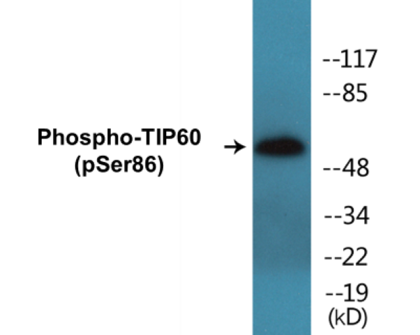 TIP60 (phospho Ser86) Cell Based ELISA Kit