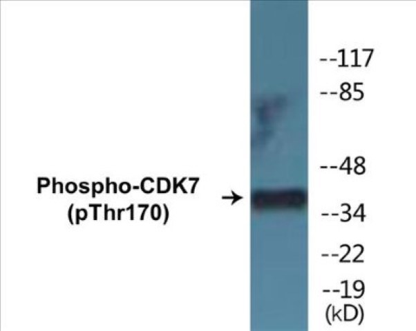 CDK7 (phospho Thr170) Cell Based ELISA Kit