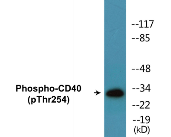 CD40 (phospho Thr254) Cell Based ELISA Kit