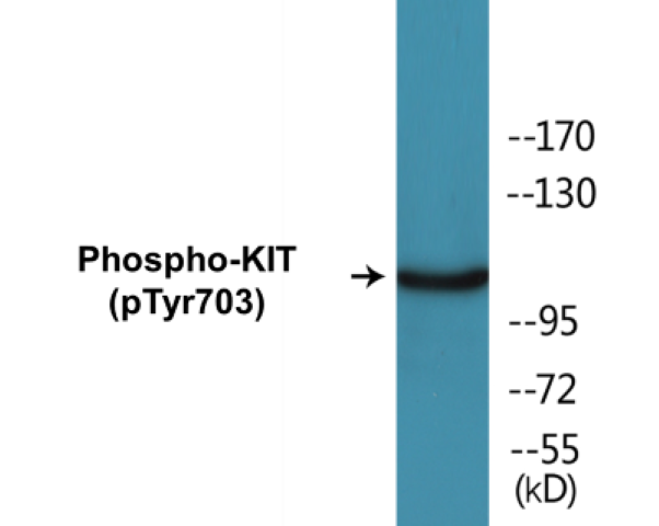 KIT (phospho Tyr703) Cell Based ELISA Kit