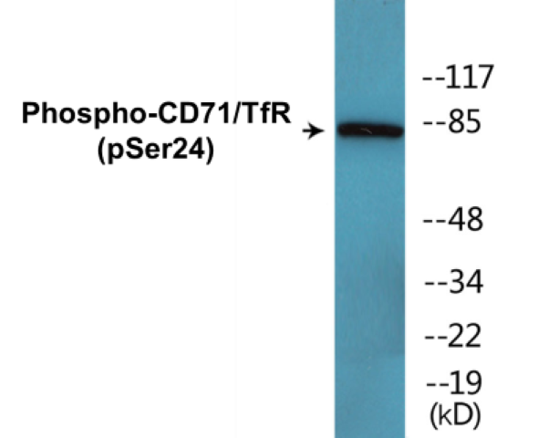 CD71 (phospho Ser24) Cell Based ELISA Kit