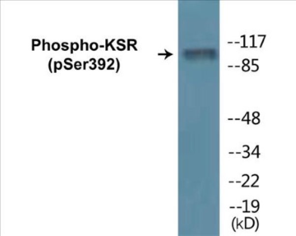 KSR (phospho Ser392) Cell Based ELISA Kit